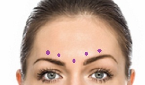 anti wrinkle injection