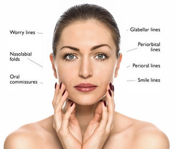 nasolabial folds